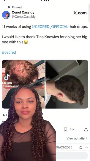 TikTok post by @sareenaakarim: How does the @CÉCRED Hair Gro Drops actually work? Does the cecred grow drops work? Hair…