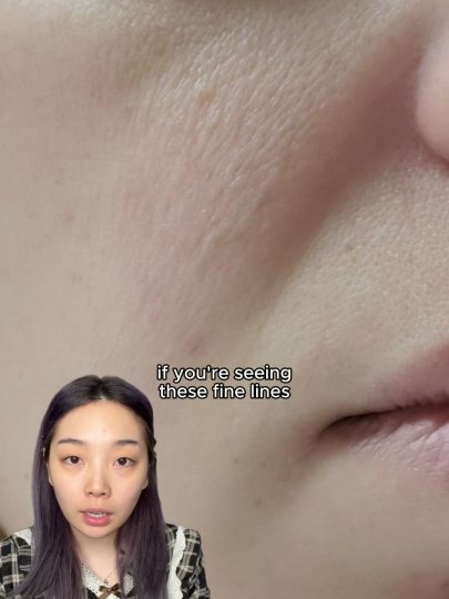 TikTok post by @_lilyis: PDRN is one of the best to help with dehydration lines and if you want to try the…