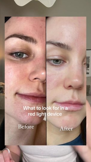 TikTok post by @chooseyourglow: Exactly how to know if a red light therapy device will work