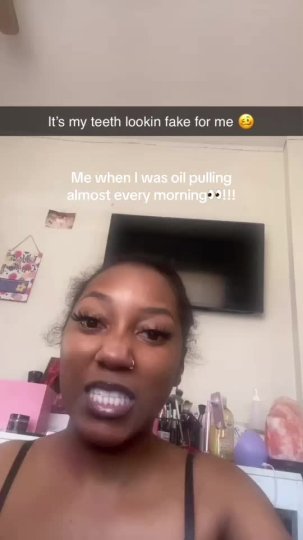 TikTok post by @_heypripri: My teeth looked soooo much whiter and fake lol, my shi look like veneers 😭😭. People would…